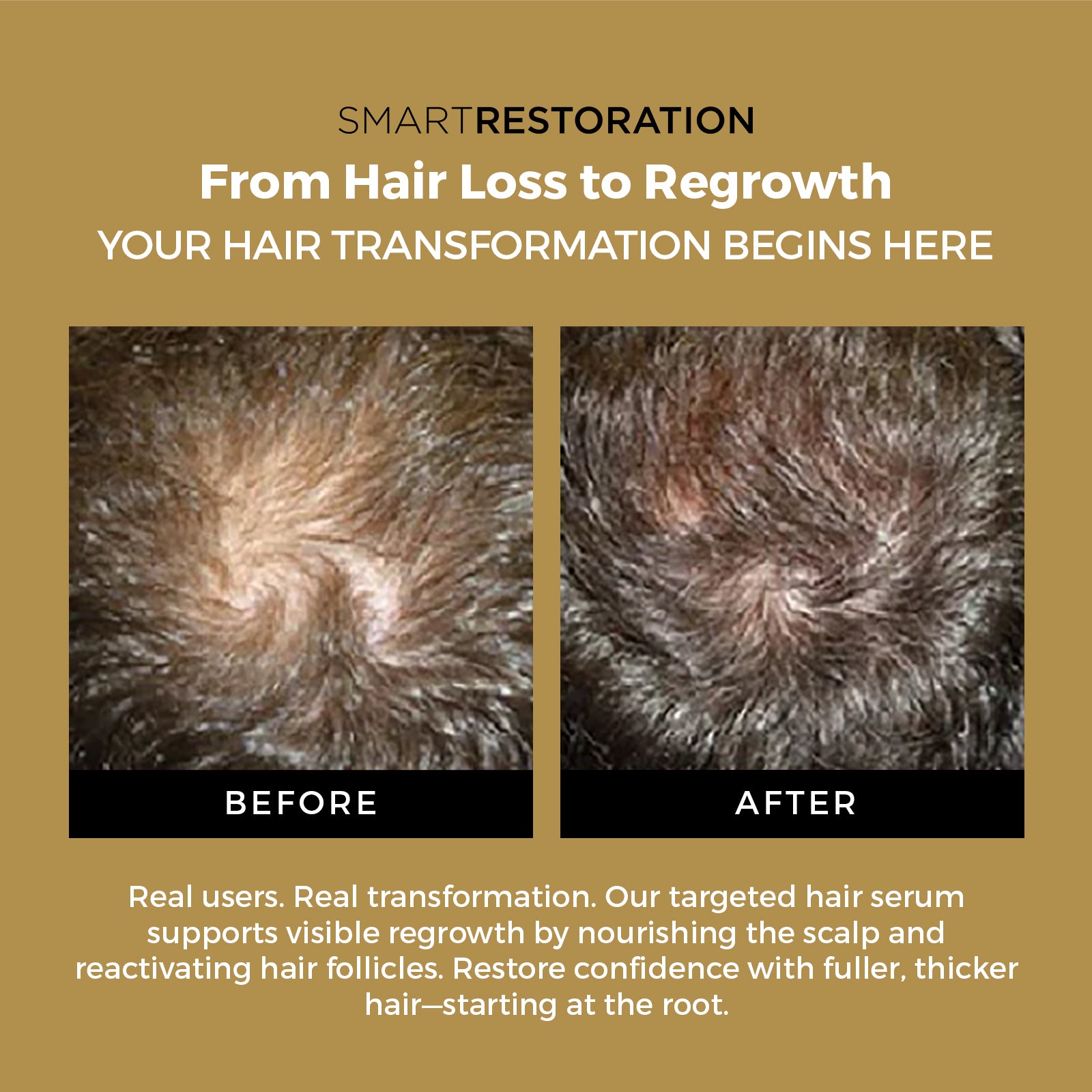 Hair growth serum before and after result