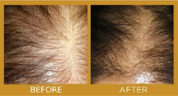 hair growth product results