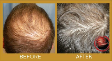 hair growth product results