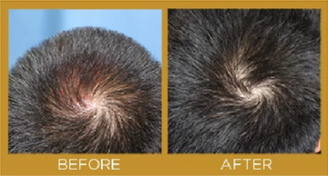 hair growth product results