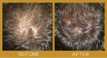 Smart restoration hair products results