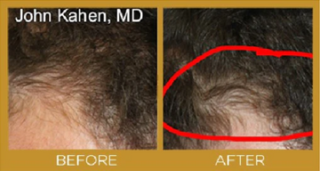Before and after results with hair care products