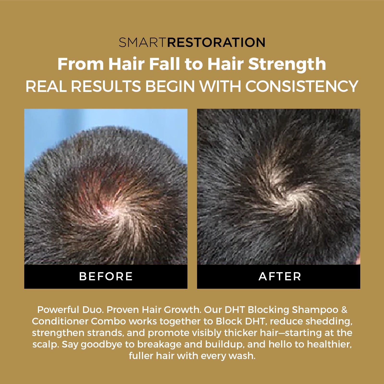 DHT blocking shampoo and conditioner before and after result 
