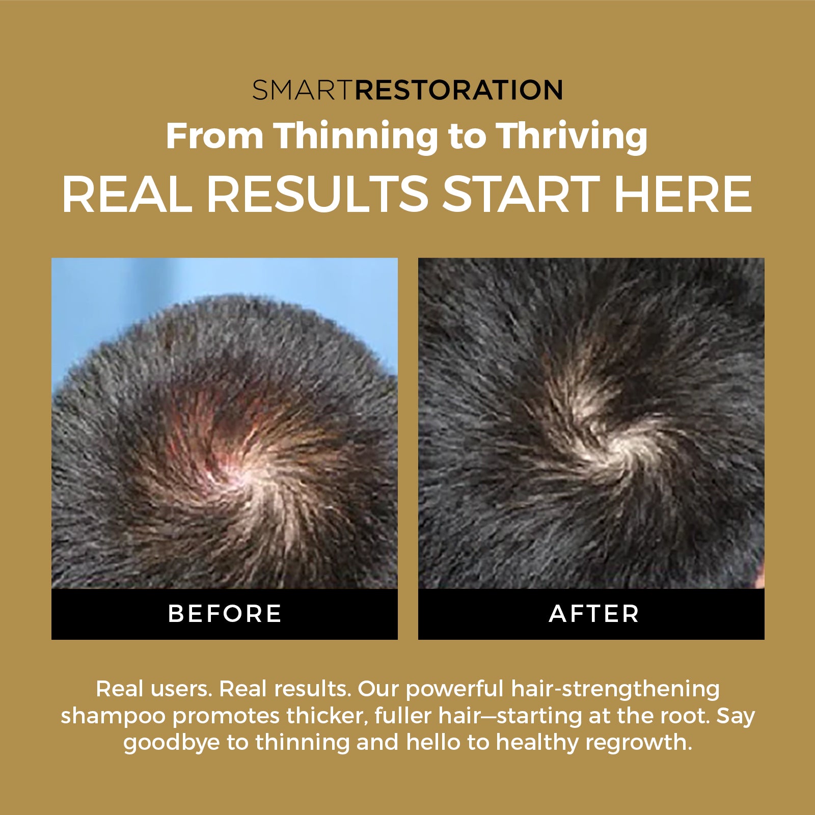 DHT blocking shampoo Before and after result 