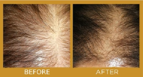 before-growing-1_1_2b92c156-059c-44e9-a9de-8c3e2fd21f80