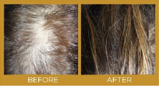 before-growing-4_1_1