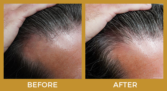 Before and after hair care products results for men